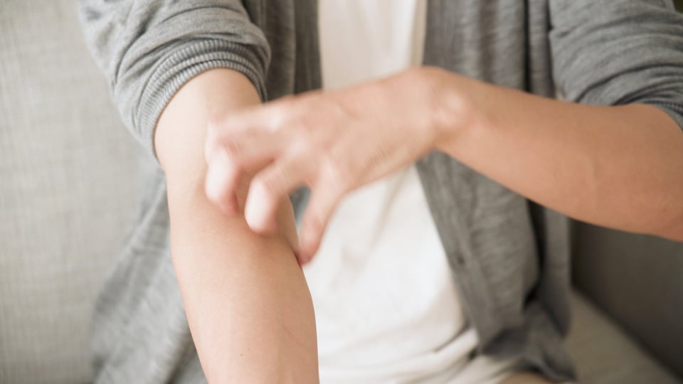 ツメダニに刺されて腕にかゆみを訴える男性